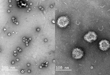 Virus-like particles: A practical alternative to cultured rubella virus